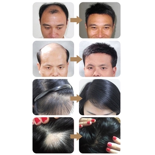3cddboom 30ml cuidado del cabello esencia crecimiento del cabello crecimiento del cabello prevención (5)