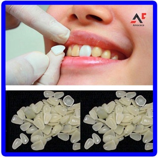 AM 50 Pcs Temporary Resin Sticker Shade Dental Whitening Veneers Teeth Upper Beauty (2)