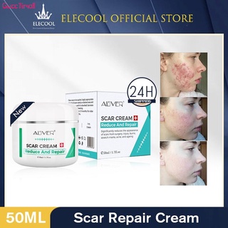 ALIVER Reparación Cicatriz Crema Eliminar La Marca Estirable Scald Cesarean Bump Cirugía Scar gucc1imall (1)