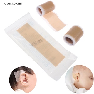 Douaoxun Baby Ear Correctors Medical Silicone Tape Infant Ear Correction Patch Stickers CL