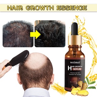 Konheart esencia con aceites esenciales Para crecimiento del cabello 30ml