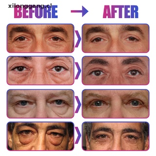 LONGANG Men's Eye Cream Dark Circles Remover Eye Bags Under The Eyes Of Tight Anti Aging .