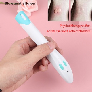 Blowgentlyflower Electronic Anti Mosquito Bite away Antipruritic Device Mosquito Repellent Insect BGF