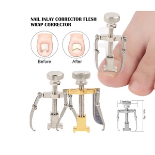 Straightening Clip Ingrown Toenail Corrector Pedicure Foot Nail Care Tools Stainless Steel Pedicure Treatment Onyxis Correction (1)
