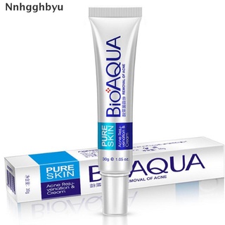 [Nnhgghbyu] 30g Acne Treatment Blackhead Remova Anti Acne Cream Oil Control Shrink Pores Hot Sale