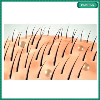 aceite germinal de jengibre crecimiento del cabello suero para el cuidado del cabello
