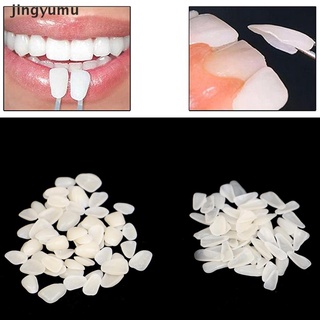 【jingy】 60Pcs Dental Ultra-Thin Whitening Veneers Resin Temporary Teeth Whitening .