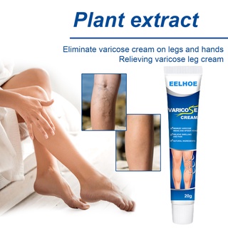 qininkn 20g spider leg gel aumentar la humedad agradable a la piel extractos de plantas varicosas crema de reparación de venas para personas obesas postparto (1)