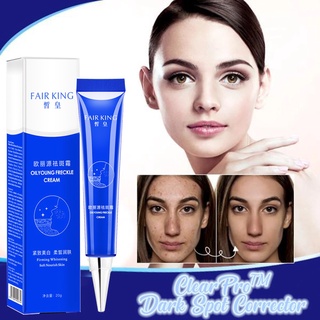 followus1^^ Blemishs Cream Removal Cream Ointment Facial Blemishs Skin Repair Cream