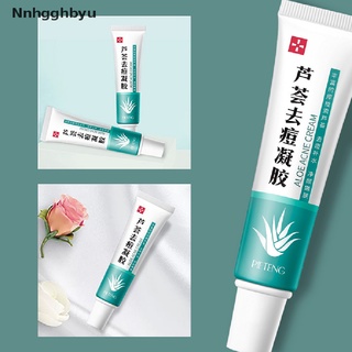 [Nnhgghbyu] Effective Acne Removal Cream Acne Treatment Fade Acne Spots Oil Control Shrink Hot Sale