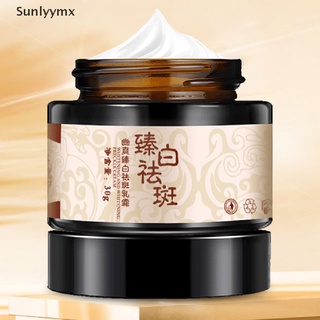 [sxm] crema de pecas blanqueamiento de la piel de plantas de hierbas crema facial eliminar pecas manchas oscuras uyk (7)