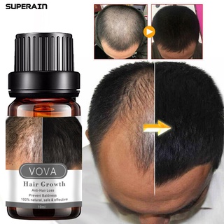 superain 10ml balance de aceite para el cabello secreción de sebo multifuncional extractos de plantas de crecimiento del cabello esencia del cuero cabelludo para salón