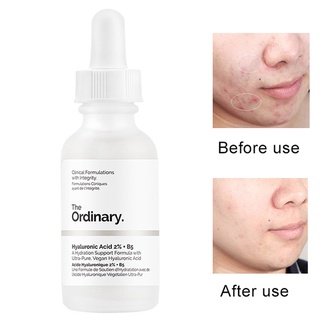 【JM】Whitening Shrink Pores Facial Skin Hyaluronic Acid B5 Essence Serums Liquid