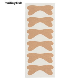Calcomanías Correctoras De Uñas Tuilieyfish/Corrector Encarnadas/Tratamiento De Paroniquia CL