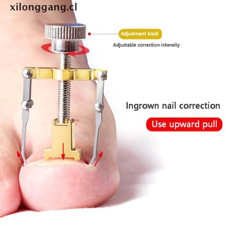corrector de uñas de pie de pie encarnado longang corrector de uñas pedicura herramienta corrector de uñas.