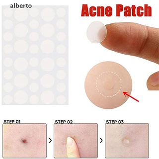 [alberto] 36 pzs parches para el acné y etiqueta de piel hidrocoloides parches removedores de acné y piel [alberto]