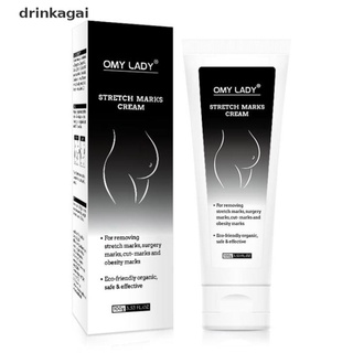 [Drinka] OMY LADY Remove Pregnancy Scars Acne Cream Stretch Mark Repair Body Cream 471CL