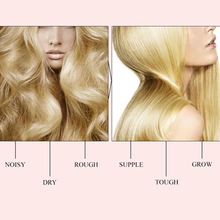meiyanqiong prevenir la pérdida de cabello producto aceite esencial uni uso (6)