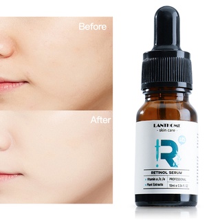 ganjou 10ml Retinol Essence Reduces Wrinkles Shrink Pore Skin Care Retinol Niacinamide Hyaluronic Acid Serum Essence for Beauty