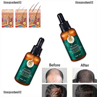 finegoodwell2 productos de crecimiento del cabello para hombres mujeres natural jengibre aceite suero crecer tratamiento rápido gloria