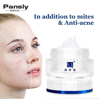 Acne Remove Cream Face Care Mite Acne Treatment Scars Nutritious Whitening Cream