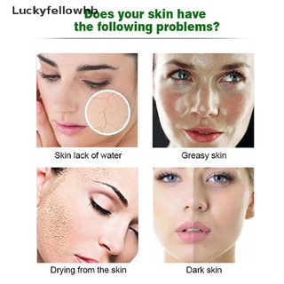 [luckyfellowhb] máscaras faciales aguacate piel anti-freckle hidratante blanqueamiento tratamiento facial [caliente] (4)