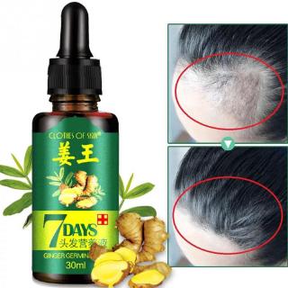 7 días aceite de jengibre tabletas 30ml anti-pérdida de cabello esencia daño reparación crecimiento cuidado del cabello esencia