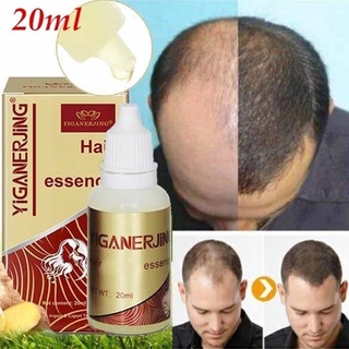 [jm] esencia de crecimiento del cabello unisex anti pérdida tratamiento del cuero cabelludo control de aceite cuidado de la salud