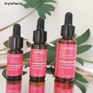 ivywhere aceite de rosa mosqueta certificado de piel orgánica aceite esencial puro y natural mejor aceite facial cl