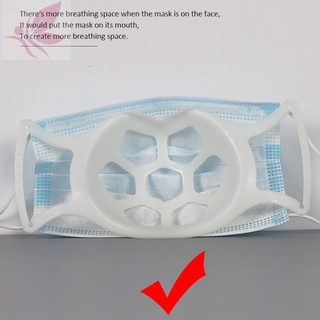 soporte de la cara de la cubierta del soporte transpirable anti-stuffy soporte de silicona de grado alimenticio cubierta de la boca soporte interior soporte stente (5)
