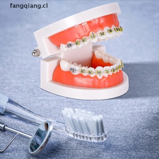 modelo dental de dientes de ortodoncia con tirantes metálicos [cl]
