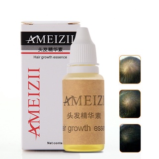 atlantamart 20ml jengibre crecimiento del cabello esencia hidratante anti pérdida del cuero cabelludo tratamiento solución