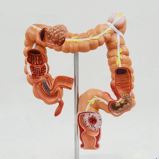 Teaching el Human Large Intestine Anatomical el Visceral Colon and Rectum Pathological el for School Hospital (2)