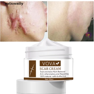 ratswaiiy crema cicatrizante eliminar cicatriz acné marca eliminación reparador inflamatorio gel de la piel ungüento cl