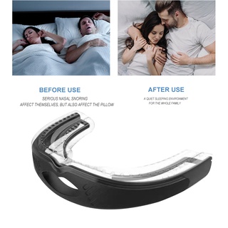 ifashion1 aparatos antirronquidos para el hogar/dispositivo de dientes para dormir mejor