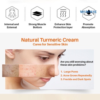 [winnie] 30g crema facial piel nutritiva blanquear acné cuidado de la piel crema reparadora para mujeres (7)