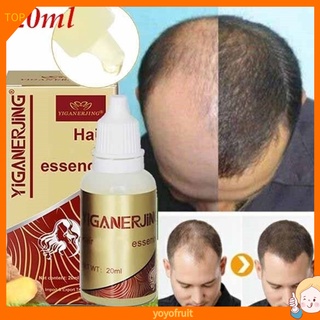 Yoyo Unisex crecimiento del cabello esencia Anti pérdida tratamiento del cuero cabelludo Control de aceite cuidado de la salud