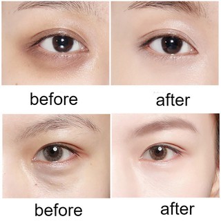 🌞Qmhut 60pcs oro niacinamida máscara de ojos eliminar bolsas de ojos círculos oscuros niacinamida jalea ojo parche 60 Pack/caja (5)