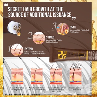 aceite de crecimiento rápido del cabello prevenir la pérdida del cabello extracto de jengibre en crecimiento productos para el cuidado del cabello y el cuero cabelludo (4)