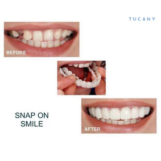 Tucany 2 pzs/juego de carillas de dentadura de dientes/cubiertas de prótesis dentales para clínica Dental (8)