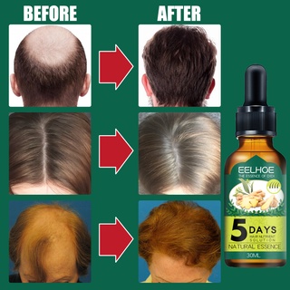 Eelhoe 30ml jengibre cuidado del cabello aceite esencial crecimiento del cabello líquido (2)