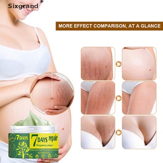 [sixgrand] crema suave para reparación de la piel de maternidad para estrías/cuidado de eliminación de cicatrices cl