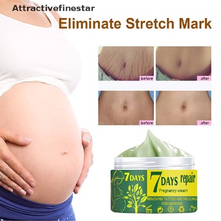 [afs] crema de piel suave para reparación de la piel de maternidad para estrías/cuidado de eliminación de cicatrices/atractivefinestar