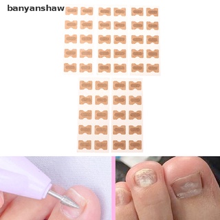 banyanshaw 5 hojas de uñas encarnadas corrector de uñas pegatinas tratamiento paroniquia recuperar herramientas cl