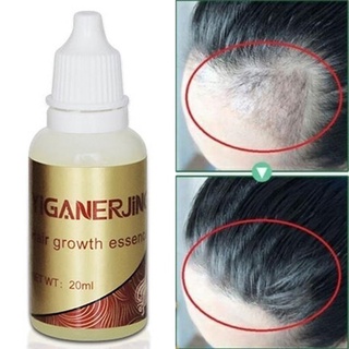 [jm] esencia de crecimiento del cabello unisex anti pérdida tratamiento del cuero cabelludo control de aceite cuidado de la salud (2)