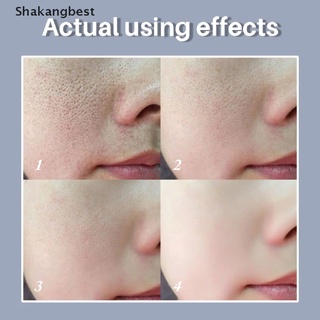 [skb] suero retráctil de poros/acido/hidratante/reparación/tratamiento de los poros faciales/esencia líquida