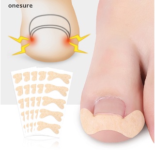 onesure 1sheet Ingrown Toe Foot Nail Correction Sticker Pedicure Toenail Corrector .