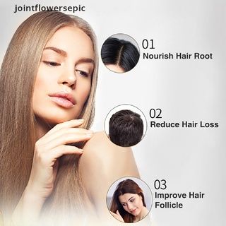 New Stock Ginger Hair Growth Essential Spray Anti Hair Loss Serum Treatment Liquid Hot (6)