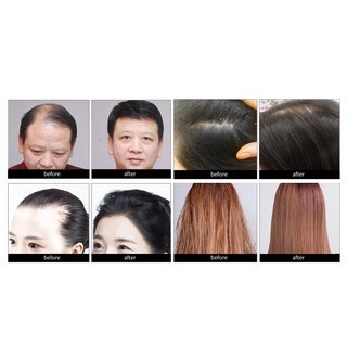 aceite esencial de crecimiento del cabello herbal 20ml masaje cuidado del cabello suero cuero cabelludo reparación