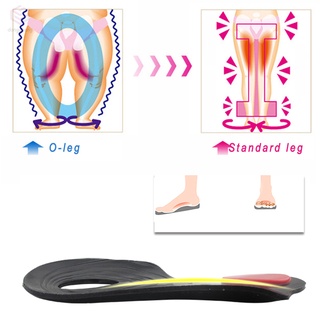 plantillas de corrección de piernas unisex o/x plantillas ortopédicas plantillas arco soporte orthats almohadilla masajeadora plantillas de zapatos pie salud (9)